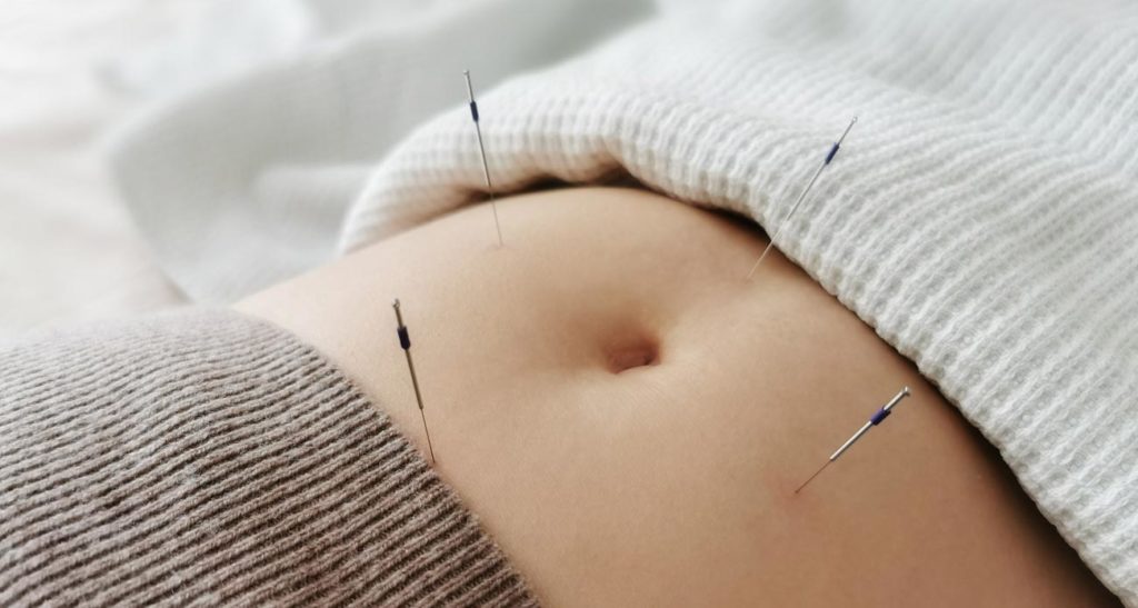 Acupuncture for pregnancy