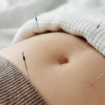 Acupuncture for pregnancy